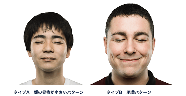 睡眠時無呼吸症候群の種類